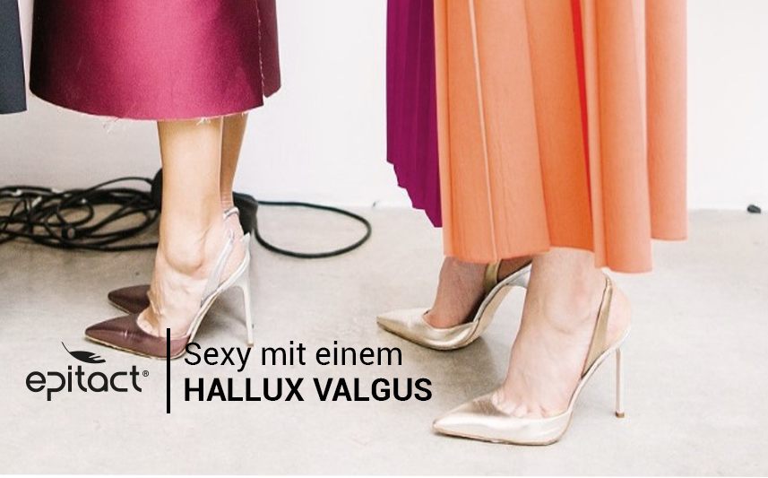 Hallux valgus und ästhetische Kriterien 