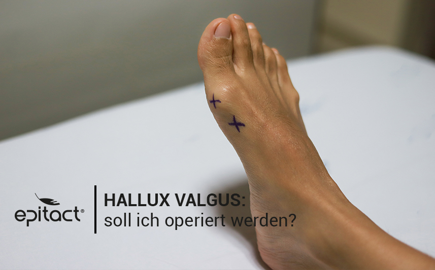 Ballenzeh: operieren oder nicht?