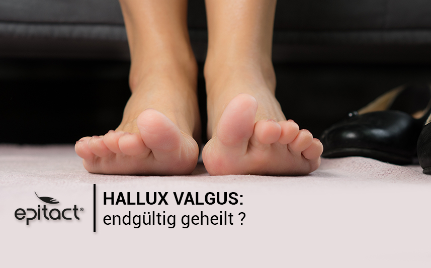 Kann ein Hallux valgus wiederkehren?