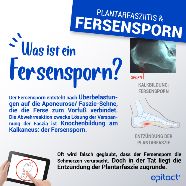 Fersensporn: was ist das