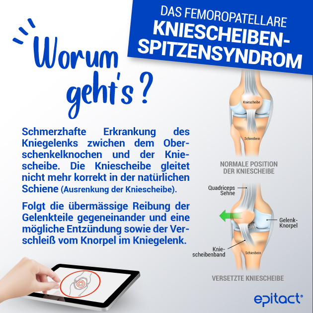 Definition des Patellaspitzensyndroms