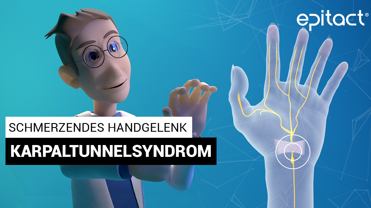 Alles über das Carpaltunnelsyndrom