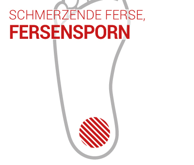 fersensporn