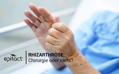 Im Falle von Rhizarthrose operiert werden?