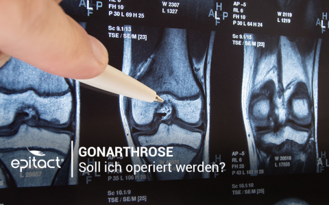 Gonarthrose: die operativen Behandlungsmethoden