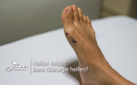 Welche operative Techniken für die Behandlung von Hallux valgus?
